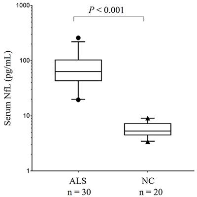 Correlational Analysis of ALS Progression and Serum NfL Measured by Simoa Assay in Chinese Patients